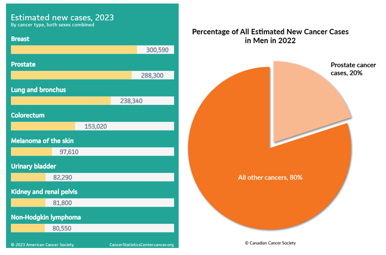 Figure 1 : Statistiques du cancer de la prostate 2022-2023.