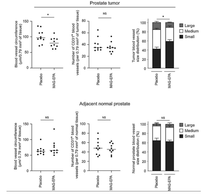 Figure 6 : Influence du MAG-EPA sur la vascularité des tumeurs prostatiques.